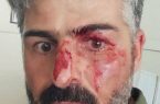 ضرب و شتم محیط‌بان کرمانشاهی توسط شکارچیان غیرمجاز در امروله صحنه