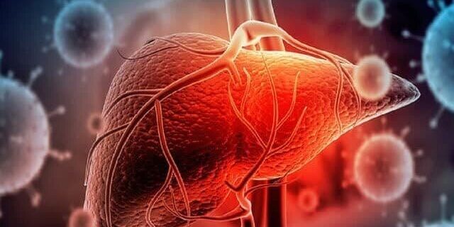 چگونه «کبد چرب» را درمان کنیم؟